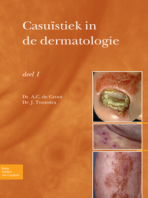 cover image of Casuïstiek in de dermatologie--deel I